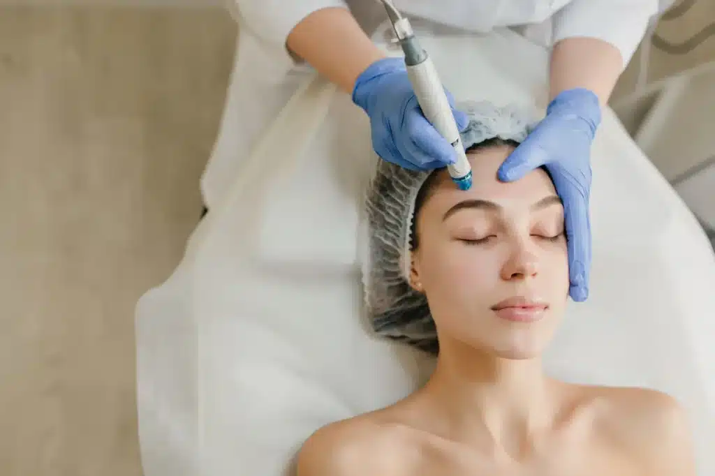 Microneedling With Depigmenting Serums